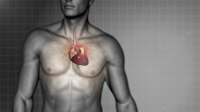 What Chest Pain Means for Athletes