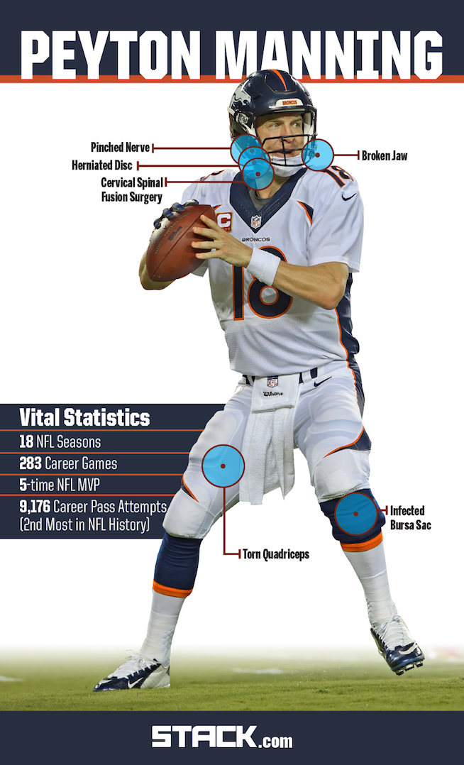 Peyton Manning and 4 Other Superstars Who Overcame a Stunning Number of